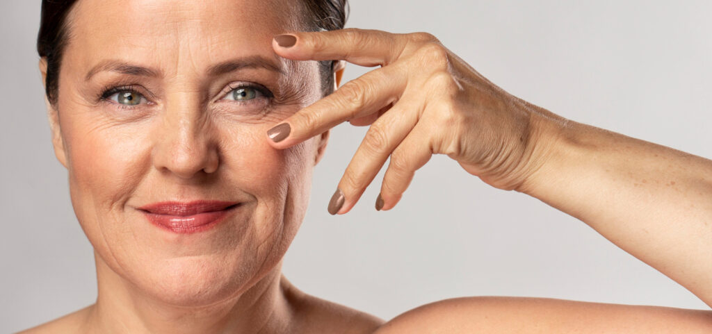 Entenda como a dermatocálase afeta o bem-estar do paciente e por que a blefaroplastia é uma aliada eficaz no tratamento